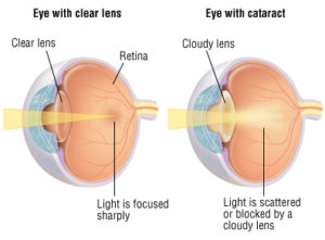 eye surgery in dogs