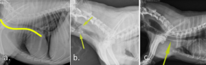 image of 3 fluoroscopic images of a thorax showing a collapse and a repair