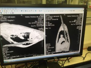 CT Images of Dakota's injury