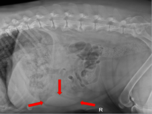 normal and enlarged spleen