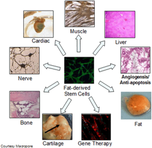 Fat derived stem cells graphic indicating the types of cell types they can be transformed into, including bone, cartilage, skin, nerves and muscles.
